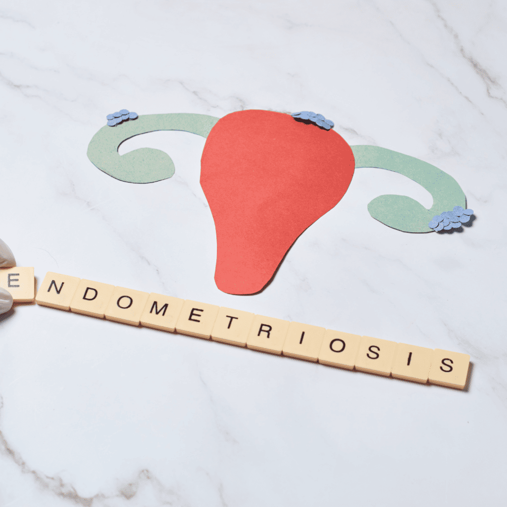 uterus cut out in colored paper with scrabble letter squares spelling out endometriosis below